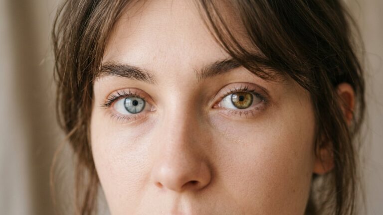 Yeux vairons : un œil bleu et un œil marron montrant l'hétérochromie