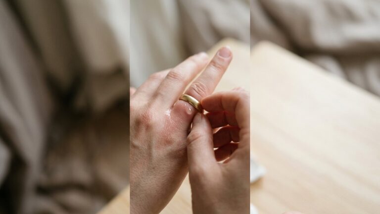 Retrait d'une bague coincée sur un doigt gonflé avec lubrifiant