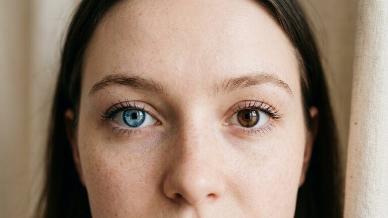 Yeux vairons : un œil bleu et un œil marron montrant l'hétérochromie