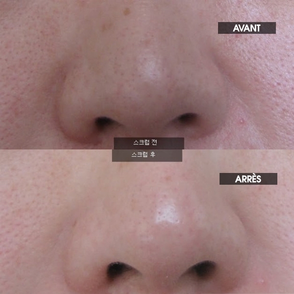 Avant / après Gommage doux Baking Powder Crunch Pore Scrub