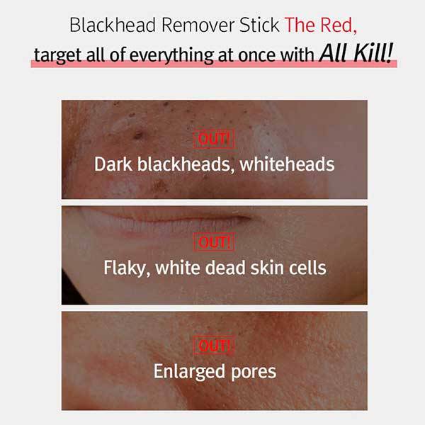 Stick anti points noirs All Kill Blackhead Remover Stick The Red