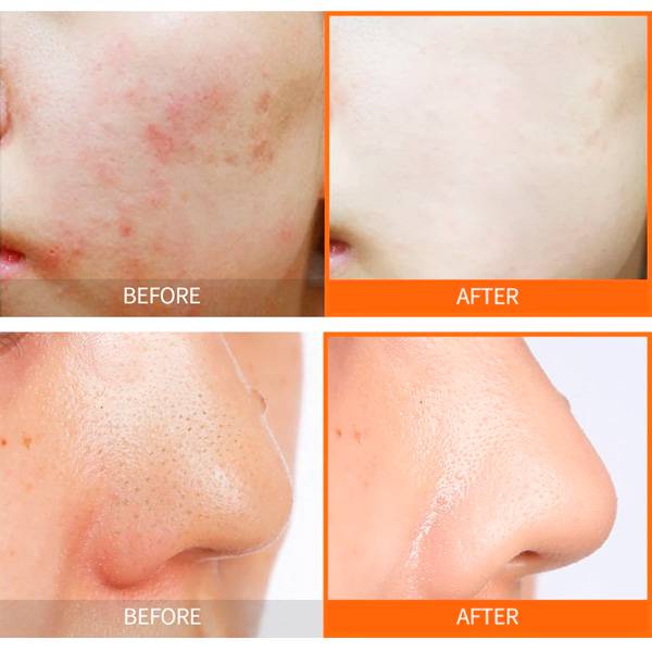 Peeling Gel Vita 7 Energy